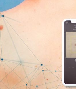 Analysis of Skinive algorithm’s  accuracy for risk assessment of skin conditions, based on machine learning algorithms.