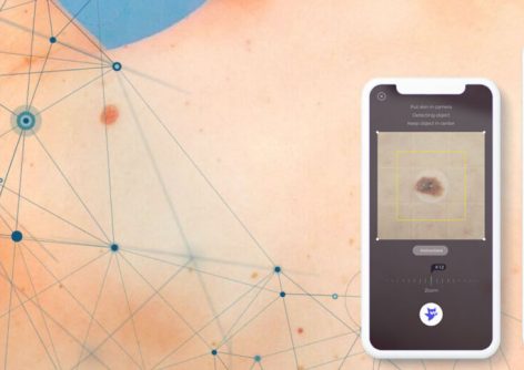 Analysis of Skinive algorithm’s  accuracy for risk assessment of skin conditions, based on machine learning algorithms.