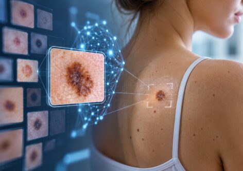 Application Mélanome Gratuite : Surveillance des Grains de Beauté